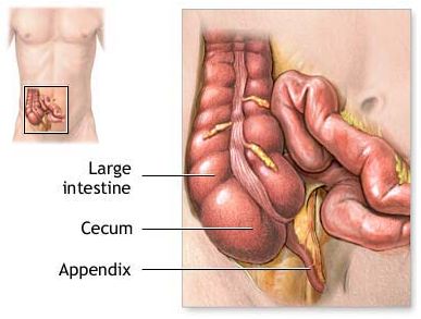 Image depicting the appendix and its position in the abdominal cavity.