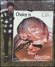 Graphic anti-abortion sign